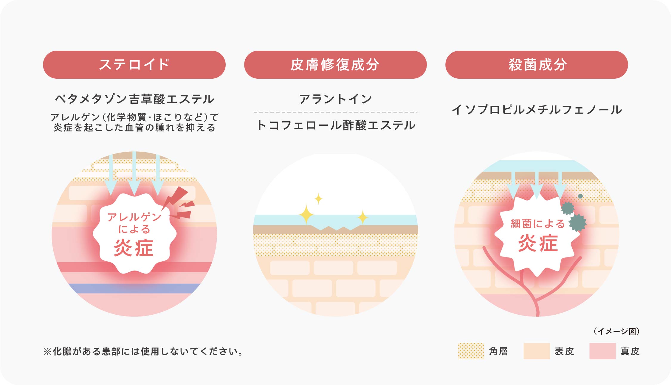 【1.ステロイド】ベタメタゾン吉草酸エステル 「アレルゲン(化学物質・ほこりなど)で炎症を起こした血管の腫れを抑える」 【2.皮膚修復成分】アラントイン、トコフェロール酢酸エステル 【3.殺菌成分】イソプロピルメチルフェノール ※化膿がある患部には使用しないでください。